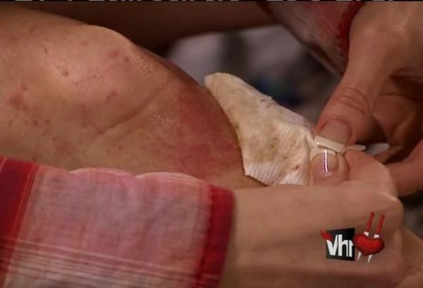 black and blue and broken bones, you left me here, now I'm looking to use this to advance my career